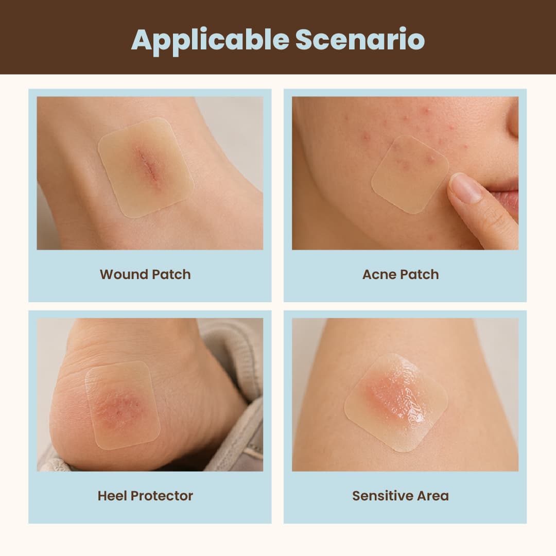 Softly Studio Hydrocolloid Roll applicable scenarios showing use as wound patch for cuts, acne patch for pimples, heel protector for blisters, and coverage for sensitive skin areas